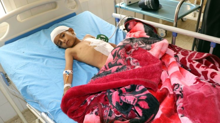Bambino yemenita ferito
