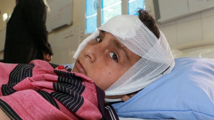 Jemen - Ein Junge mit Verletzungen durch einen Luftangriff