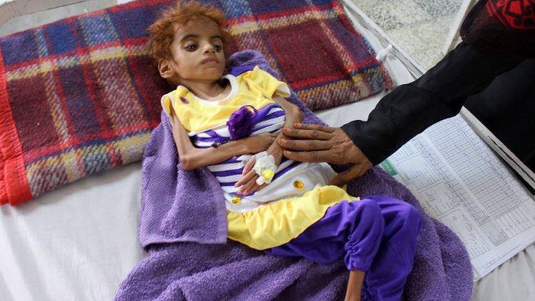U Jemenu je, zbog ratnog stanja, gladi izloženo oko 18 milijuna ljudi, odnosno dvije trećine populacije