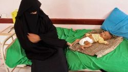 yemen-conflict-health-children-1541672304936.jpg