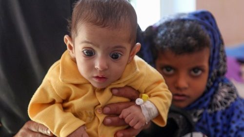 Yémen : 85 000 enfants morts de faim ou de maladie depuis 2015