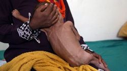 topshot-yemen-conflict-malnutrition-1542819725364.jpg