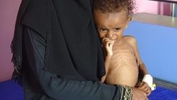 yemen-conflict-famine-children-1543526032118.jpg