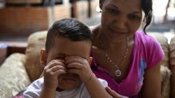 venezuela-crisis-undernourishment-1549937104230.jpg