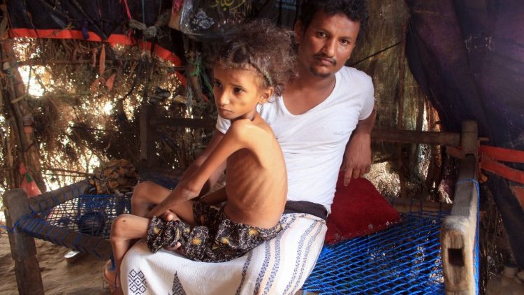 نداء من اليمن: الأطفال يحتاجون إلى الدواء والطعام والتربية