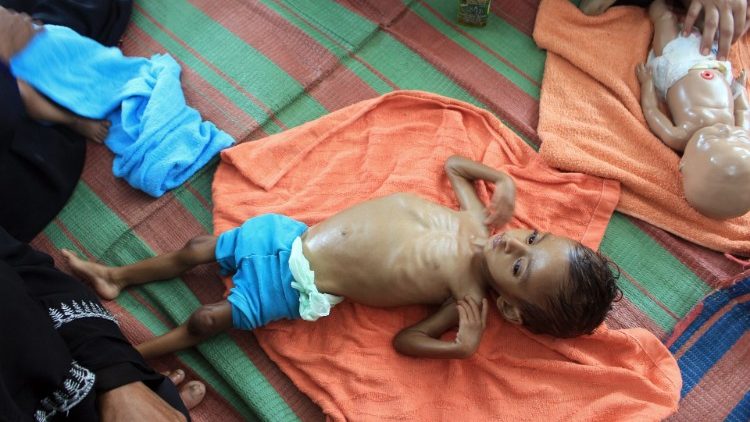 Hungernde Kinder im Jemen