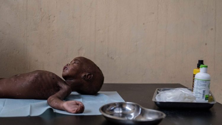 In vielen Teilen der Welt sind Kinder noch heute von Hunger bedroht