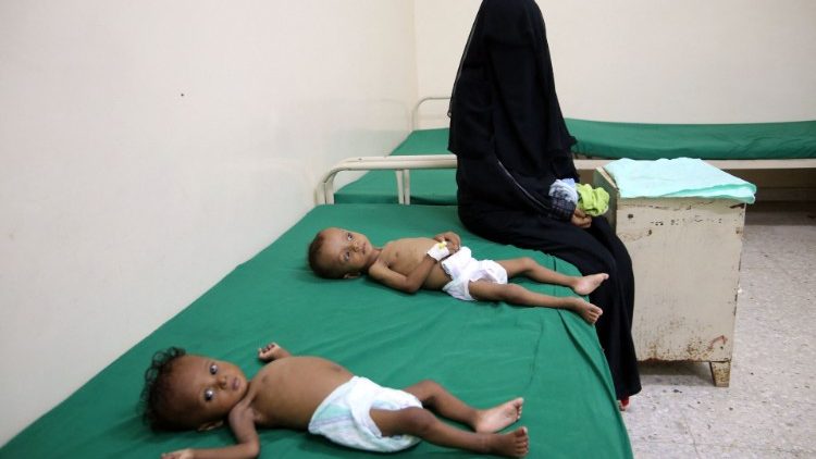Eine Untersuchung von mangelernährten Kindern im Jemen