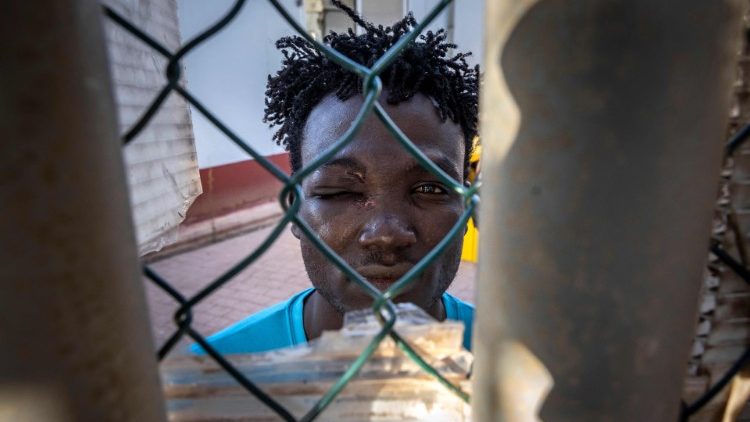 Un migrante sudanés con una herida en el ojo n el centro temporal para inmigrantes y solicitantes de asilo en el enclave español de Melilla, cerca de la ciudad marroquí de Nador, el 25 de junio de 2022. 