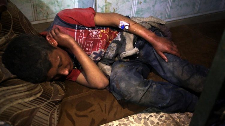 Uno dei civili colpito dai gas a Douma