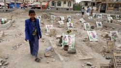 child-casualties-due-to-yemen-conflict-1530113061016.jpg