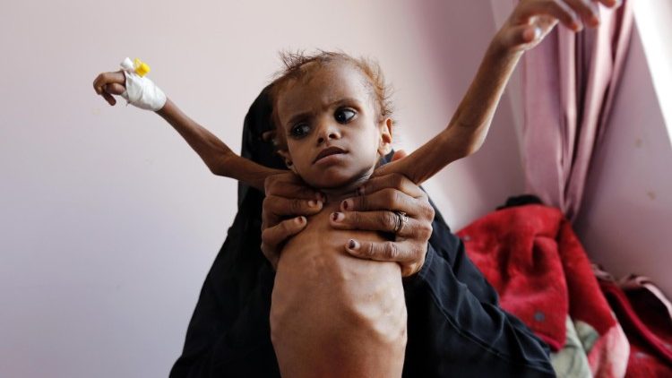 Papież o tragedii w Jemenie: krzyk głodujących dzieci wznosi się do Boga 