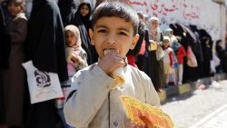 conflict-affected-yemenis-receive-free-food-r-1541271978156.jpg