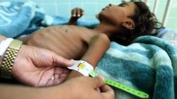 unicef-bambini-sotto-attacco--2018--anno-terr-1545985131025.jpg