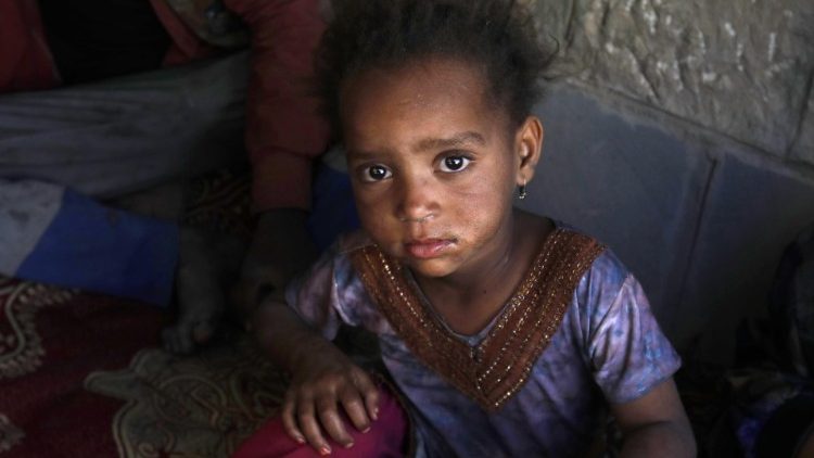 Ein Kind in einer Hilfsorganisation im Jemen