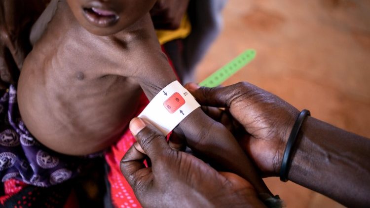 Secondo l'Unicef ad agosto, ogni minuto, un bambino somalo è stato ricoverato per malnutrizione acuta grave (Ansa)