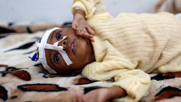 Niekończący się dramat dzieci w Jemenie 