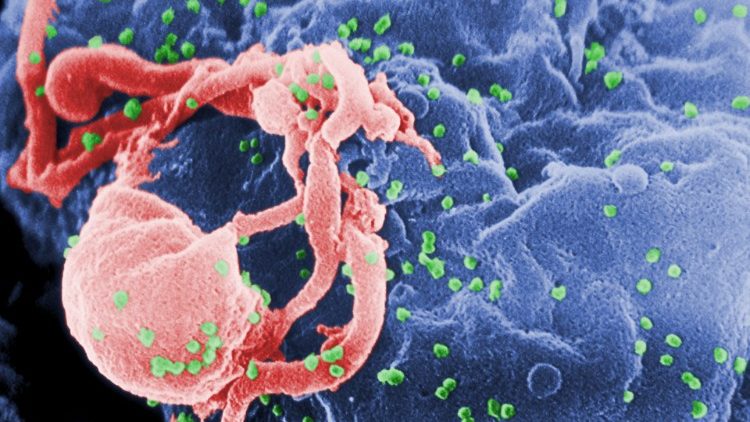 HIV-1-Viruspartikel unter dem Mikroskop