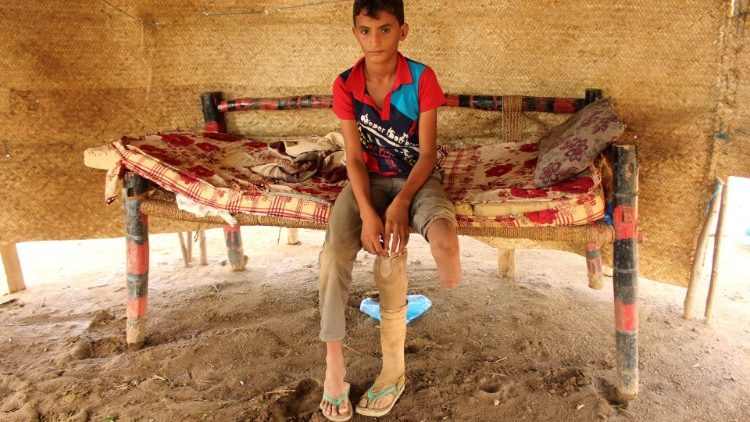 Der 12jährige Ismail Abdullah hat vor zwei Jahren bei einem Luftangriff ein Bein verloren