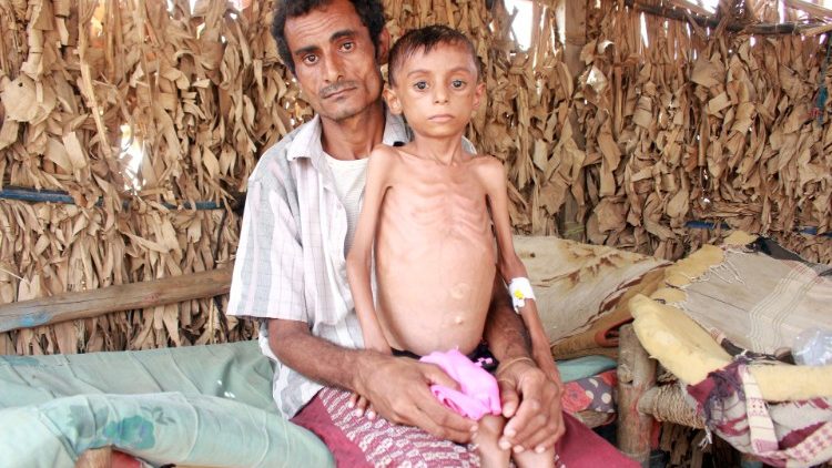 W ciągu pół roku w Jemenie może być nawet milion głodujących więcej 