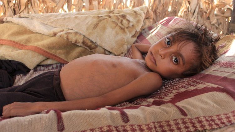 Jemeński chłopiec walczy z głodem