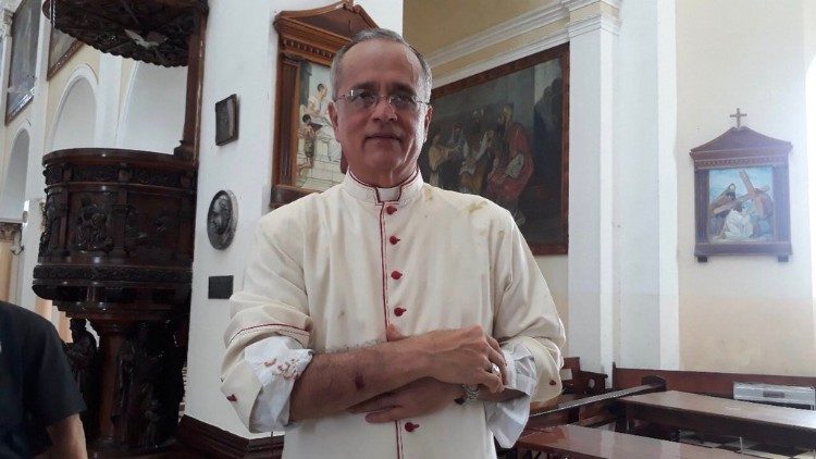 腕を負傷した、ニカラグア・マナグア教区のルヴィオ・バエス補佐司教