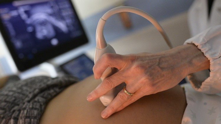 Екография на бременна жена
