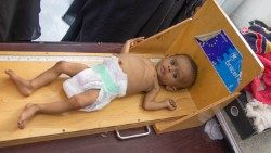 3Yemen-Aden-aiuti-PAM-fame-bambini-madri-Awadh.jpg