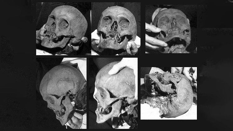 As fotos do crânio de São Vicente que permitiram a reconstrução facial
