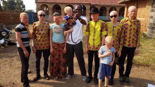 Madagascar: les albinos victimes d’enlèvements 